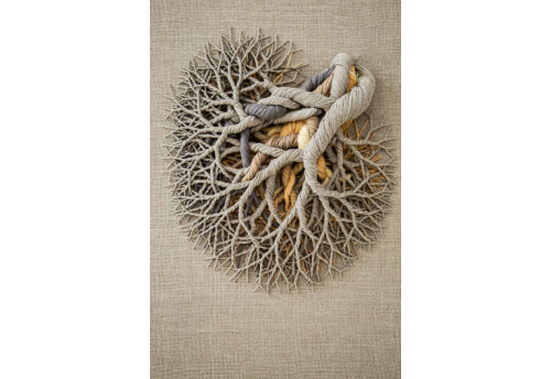 Ciclotrama 215 (Superstrato)